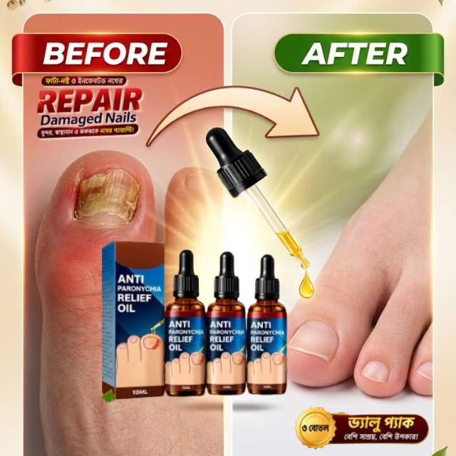 JAYSUING – Anti-Paronychia Relief Oil(10 ml)